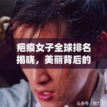疤痕女子全球排名揭晓，美丽背后的坚韧传奇故事引人瞩目
